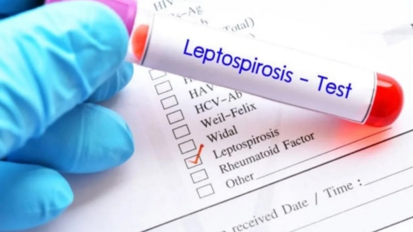 Leptospirosis: refuerzan la prevención sanitaria en establecimientos ganaderos