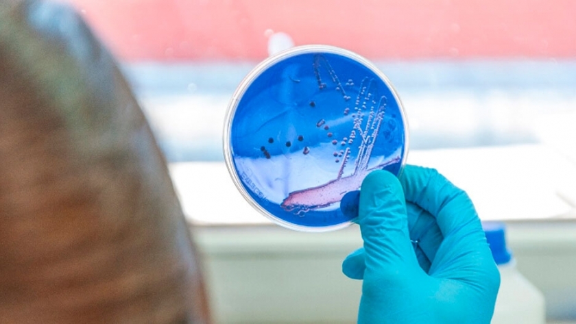 Descubren una nueva bacteria que come biomasa