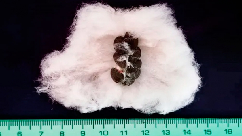 Algodón Kidney: Un Reciente Descubrimiento En La Región Amazónica Peruana