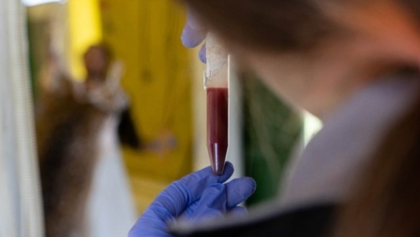 Senasa implementa un sistema para agilizar la toma de muestras