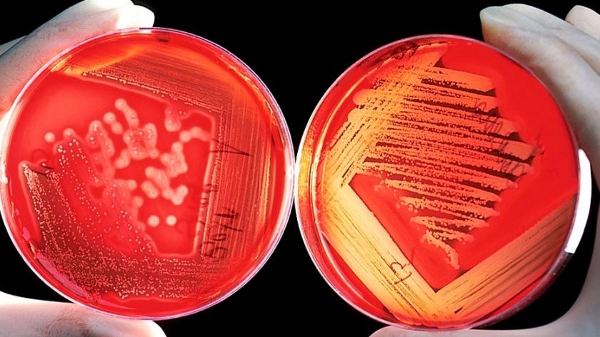 Crean una súper E.Coli que sobrevive a base de una dieta de dióxido de carbono