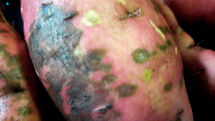 A qué se deben las manchas oscuras en la piel de la batata y cómo prevenirlas